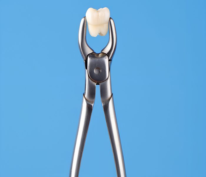 dental-extraction-forceps-holding-extracted-molar-tooth-oral-surgery-dentistry-concept