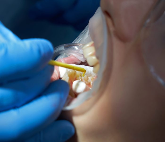 Dentist doing a dental treatment on a patient in medical clinic