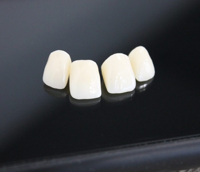 teeth